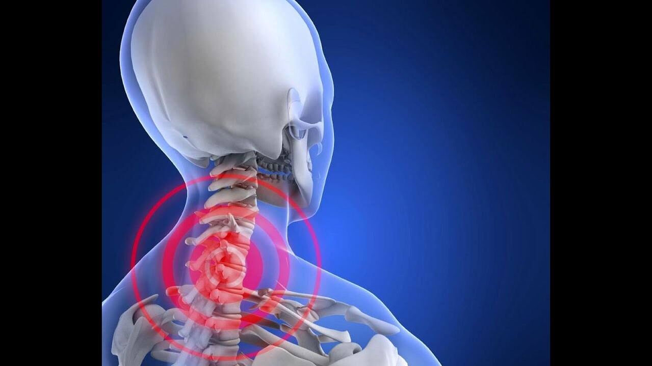 Osteocondrosis of cervical waist