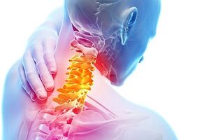 The main signs and symptoms of cervical osteocondrosis