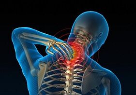 Why does cervical osteocondrosis develop